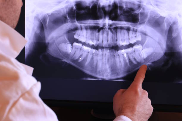 Best Emergency Dental Care for Sports Injuries in Newport, MN
